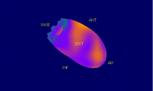 KARDIOLOGIA NUKLEARNA D-SPECT